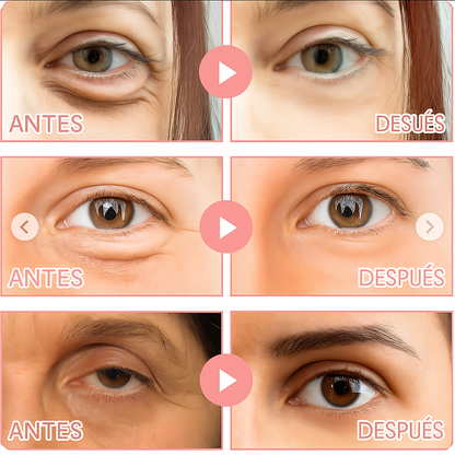 Parches MicroGlow by Pearl Secrets